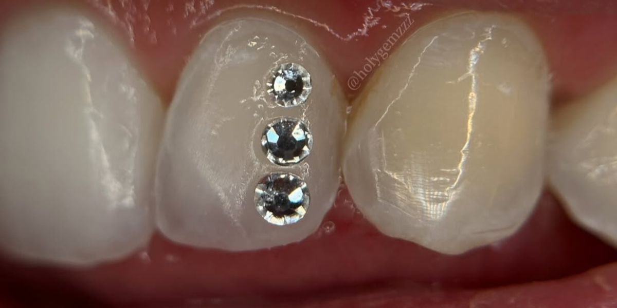 gemas-dentales-madrid.